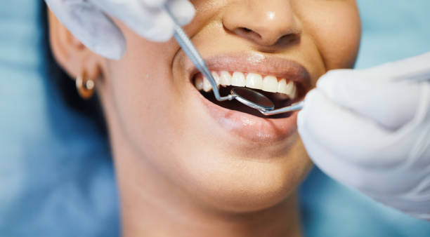 Best Emergency Wisdom Teeth Removal in Philippi, WV